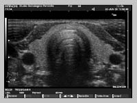 ecografie musculoscheletala ploiesti lichidul în articulația cotului nu doare